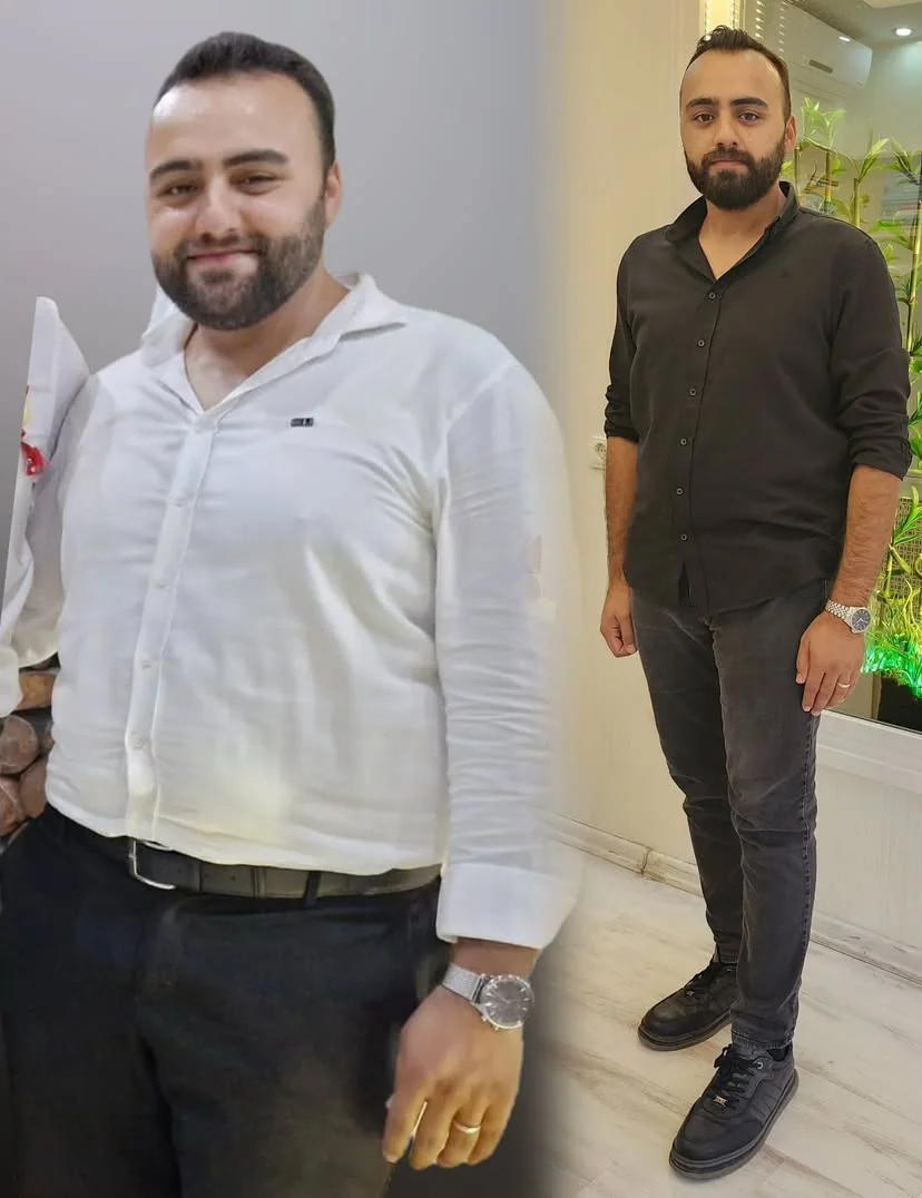 Danışan önce ve sonra başarı hikayesi