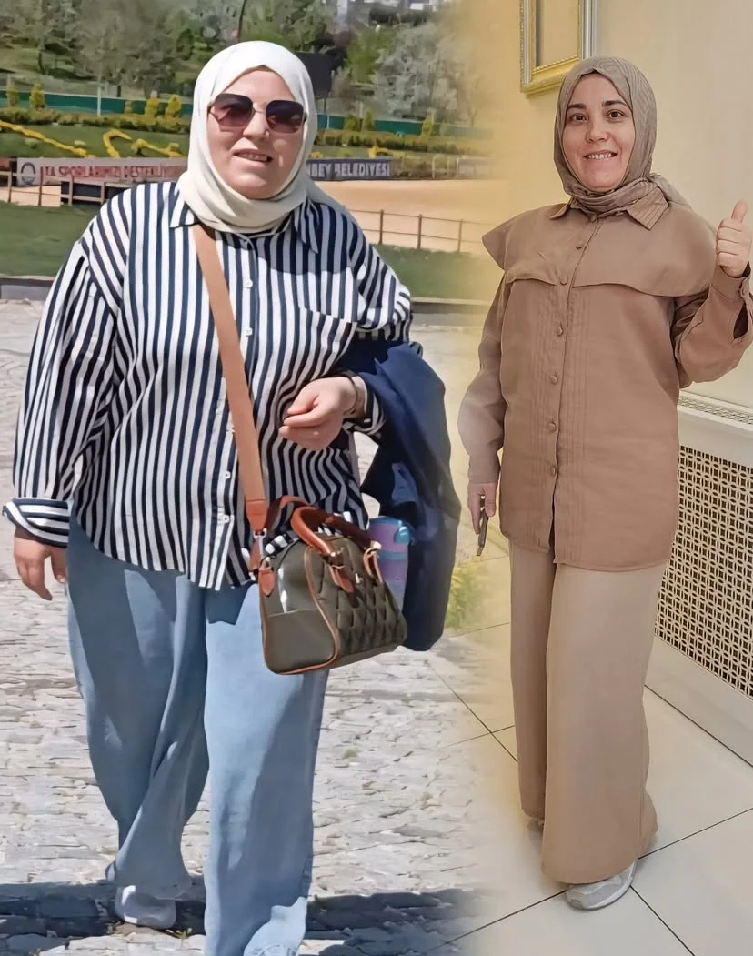 Danışan önce ve sonra başarı hikayesi