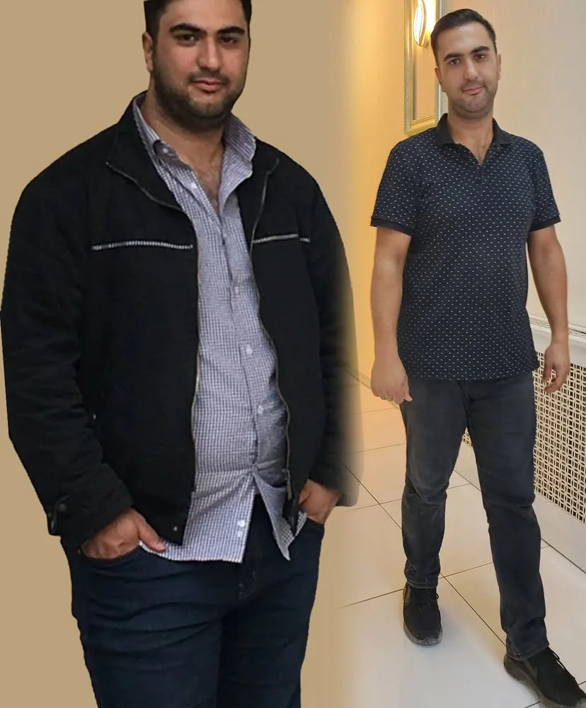 Danışan önce ve sonra başarı hikayesi
