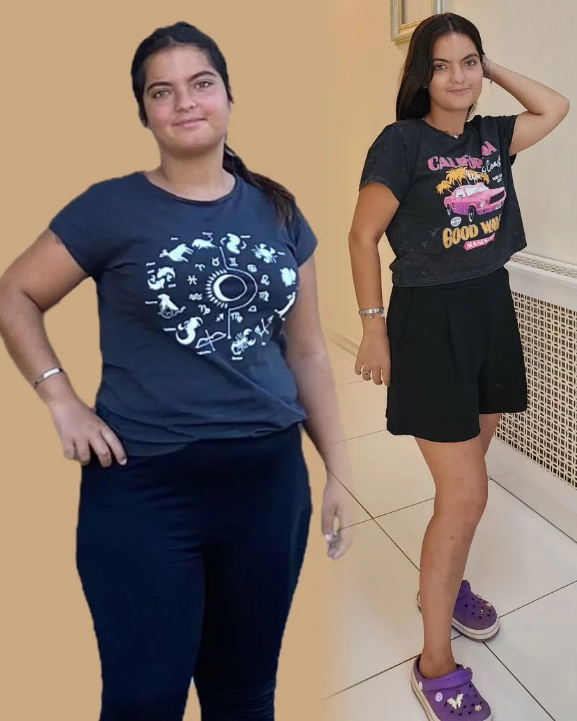 Danışan önce ve sonra başarı hikayesi